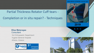 Μερική ρήξη υπερακανθίου: Συρραφή επιτόπου ή ολοκλήρωση και συρραφή; - Partial Thickness Rotator Cuff tears - Completion or in situ repair? Techniques