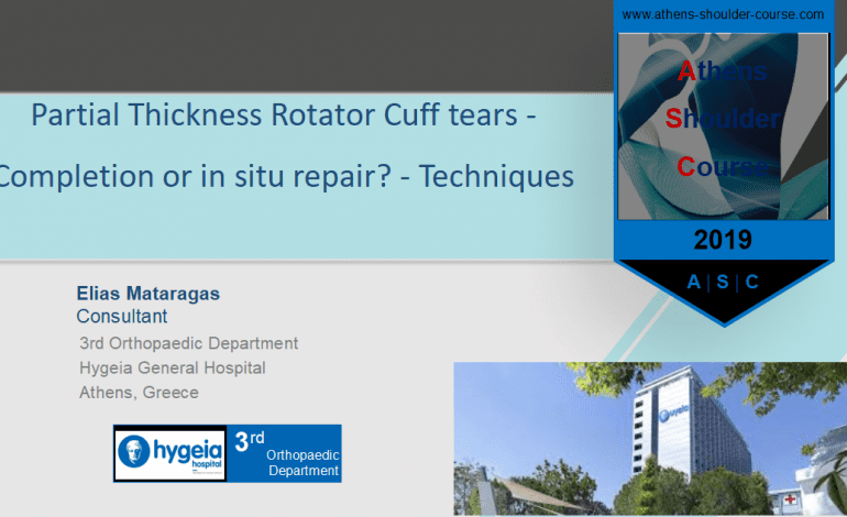 Μερική ρήξη υπερακανθίου: Συρραφή επιτόπου ή ολοκλήρωση και συρραφή; – Partial Thickness Rotator Cuff tears – Completion or in situ repair? Techniques