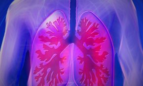 Τι είναι η πνευμονική ίνωση; Συμπτώματα, Διάγνωση