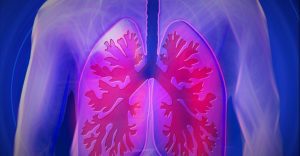 Τι είναι η πνευμονική ίνωση; Συμπτώματα, Διάγνωση